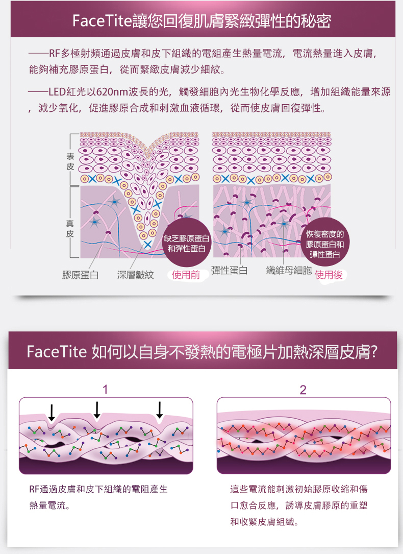 Silk'n HEALTH147 FaceTite 三源塑顏射頻機